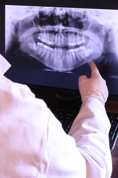 Best Emergency Dental Extractions in Woodbridge, CA