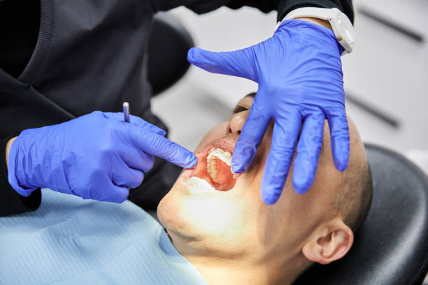 Best Emergency Dental Extractions in Woodbridge, CA